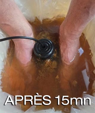 Soin de détoxication ionique - Après 15mn
