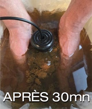 Soin de détoxication ionique - Après 30mn